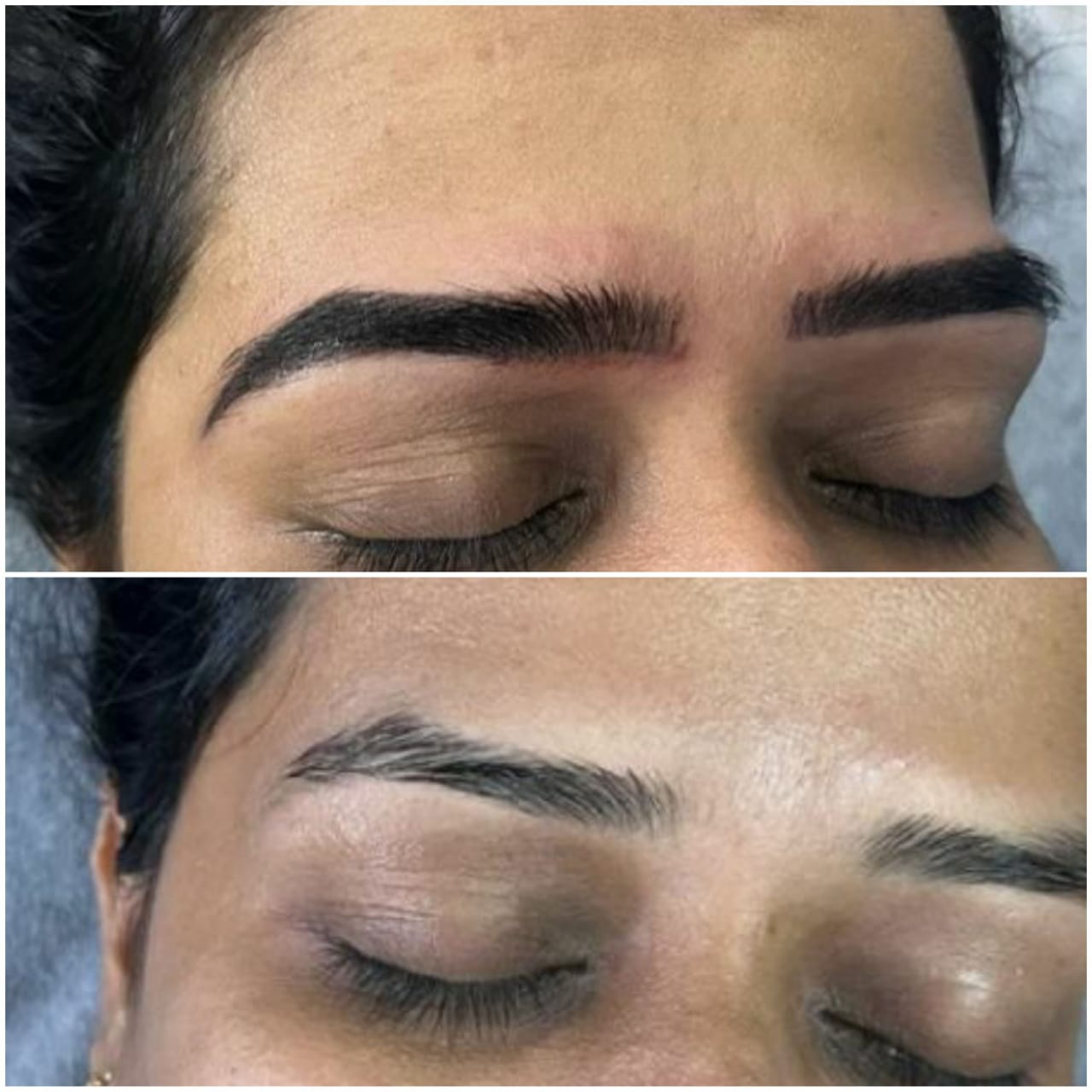 Eyebrow Enhancement